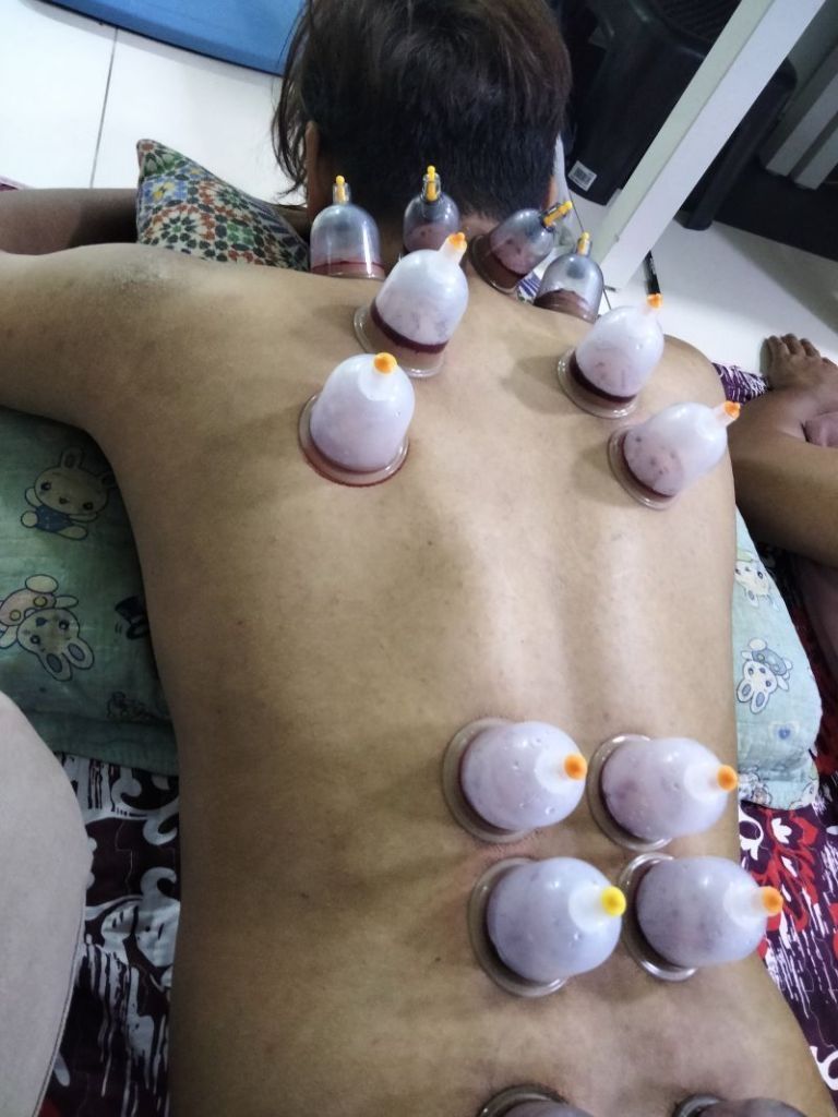 Wan Terapi URUT BEKAM Meru Klang